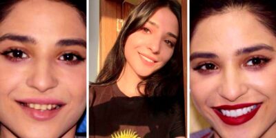 Smile Makeover: Ramsha Khan Before and After Fixing her Teeth!